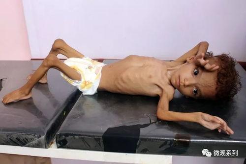 骨瘦如柴图片表情包